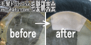 かつら修理例9