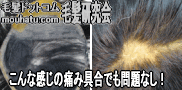 カツラ修理心配無用1