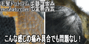 カツラ修理心配無用9